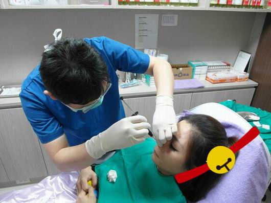 Misko隆鼻讓我鼻子變得挺拔嬌俏無(wú)壓力