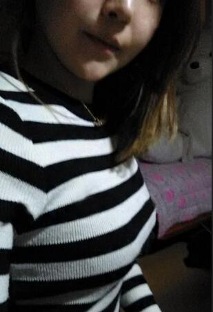 成都艾米麗自體脂肪隆胸三個(gè)月啦~