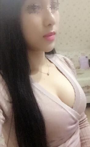 艾米麗自體脂肪隆胸恢復(fù)經(jīng)歷