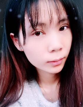 長沙美之峰重瞼+開眼角恢復過程圖