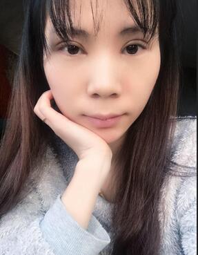 長沙美之峰重瞼+開眼角恢復過程圖