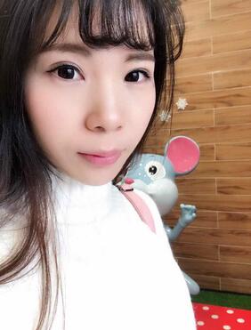 長沙美之峰重瞼+開眼角恢復過程圖