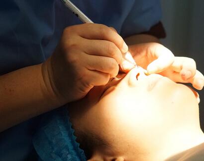 長沙美之峰假體隆鼻恢復日記