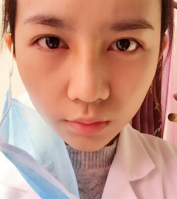 長沙美之峰假體隆鼻恢復日記