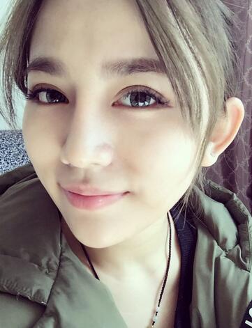 長沙美之峰假體隆鼻恢復日記