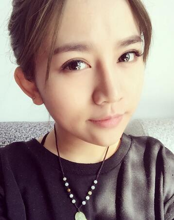 長沙美之峰假體隆鼻恢復日記