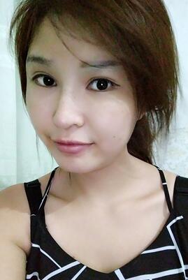 長沙美之峰隆鼻整形手術(shù)恢復(fù)日記圖