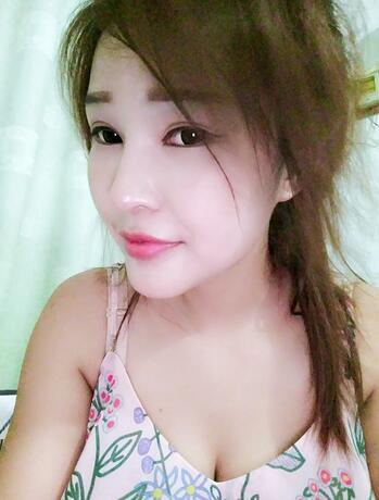 長沙美之峰隆鼻整形手術(shù)恢復(fù)日記圖