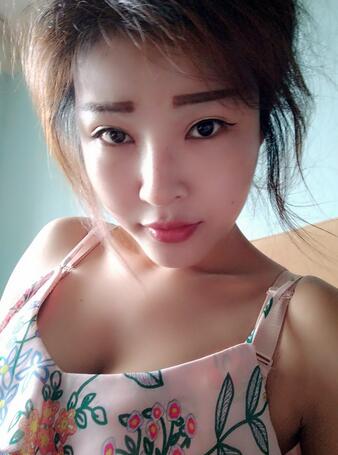 長沙美之峰隆鼻整形手術(shù)恢復(fù)日記圖