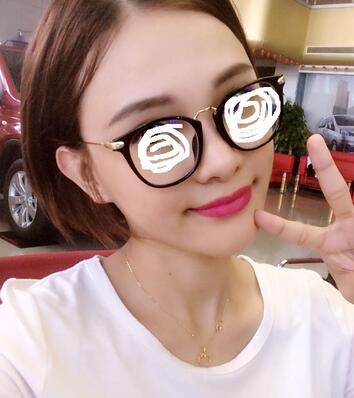 玻尿酸豐太陽(yáng)7天果圖 愛(ài)悅麗格豐太陽(yáng)穴一個(gè)月啦~