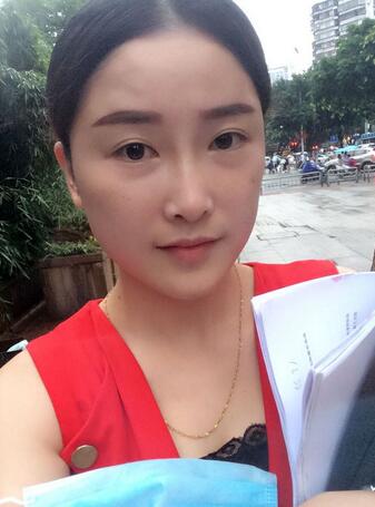 愛悅麗格玻尿酸豐蘋果肌、豐下巴、隆鼻