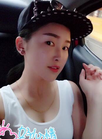 愛悅麗格玻尿酸豐蘋果肌、豐下巴、隆鼻