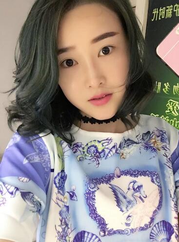 愛悅麗格玻尿酸豐蘋果肌、豐下巴、隆鼻