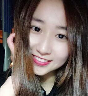 武漢中愛自體脂肪豐臥蠶日記