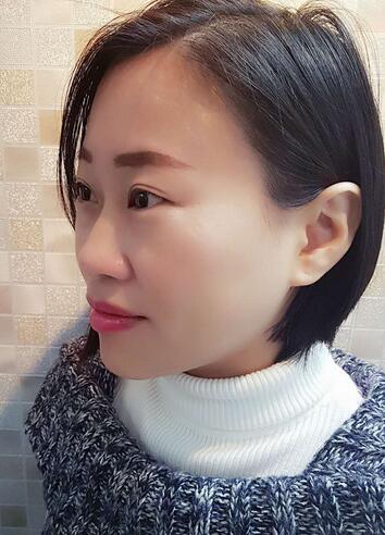 武漢中愛注射瘦臉去魚尾紋一個月