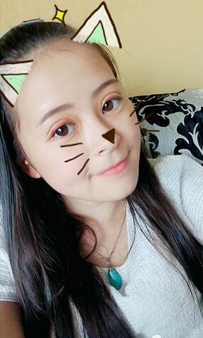 梨花雨割雙眼皮恢復半年了