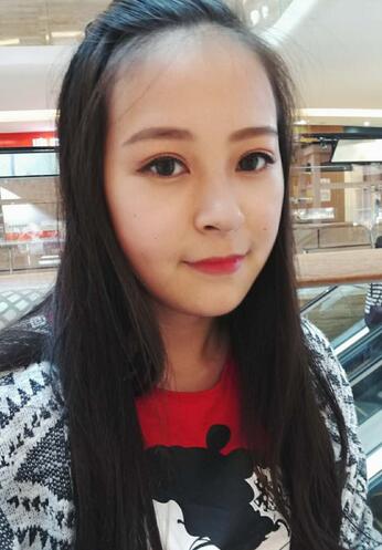 梨花雨割雙眼皮恢復半年了