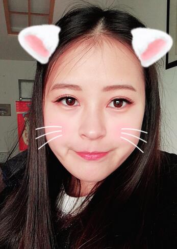 梨花雨割雙眼皮恢復半年了