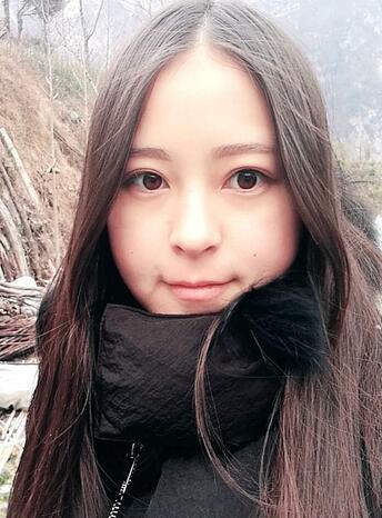 梨花雨割雙眼皮恢復半年了