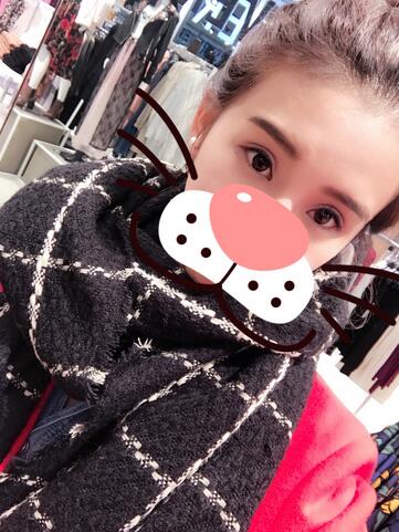 上海韓鏡割雙眼皮一個月