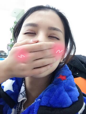 上海韓鏡割雙眼皮一個月