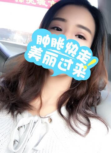 上海韓鏡割雙眼皮一個月