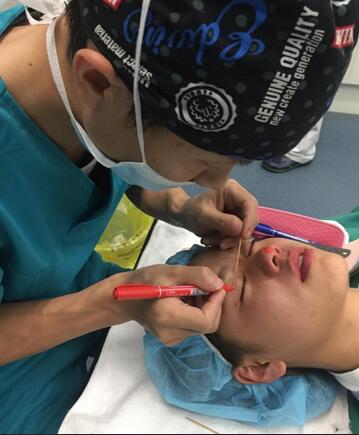 上海韓鏡網(wǎng)紅套餐半個月經(jīng)歷 雙眼皮多項整形+隆鼻整形+脂肪填充