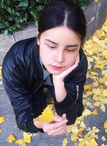 上海韓鏡網(wǎng)紅套餐半個月經(jīng)歷 雙眼皮多項整形+隆鼻整形+脂肪填充