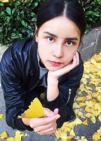 上海韓鏡網(wǎng)紅套餐半個月經(jīng)歷 雙眼皮多項整形+隆鼻整形+脂肪填充