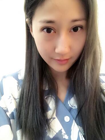 埋線雙眼皮七天恢復(fù)圖