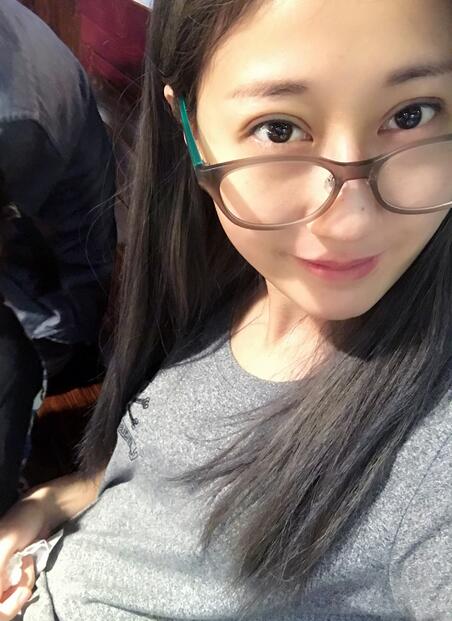 埋線雙眼皮七天恢復(fù)圖