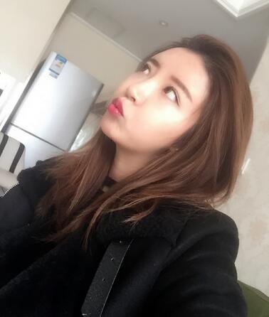 自體脂肪填充全臉1個月經歷