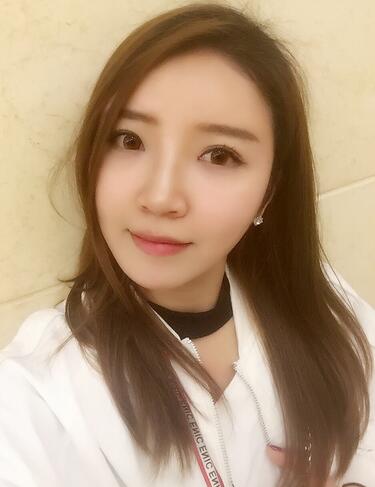 自體脂肪填充全臉1個月經歷