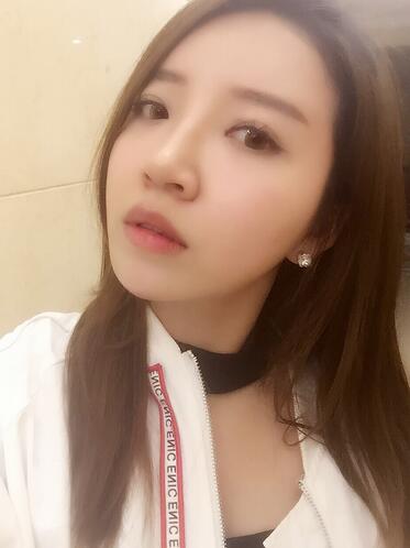 自體脂肪填充全臉1個月經歷