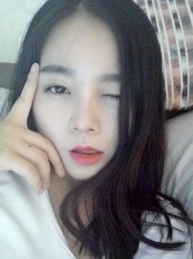 隆鼻整形日記 重慶鉑生硅膠隆鼻＋耳軟骨鼻尖