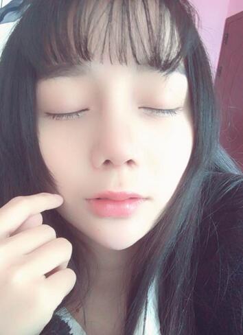 隆鼻修復術后恢復期經(jīng)歷