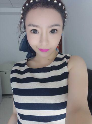 發(fā)際線調(diào)整案例分享 北京熙朵發(fā)際線+眉毛種植