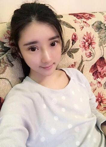 雙眼皮修復(fù)+自體脂肪填充恢復(fù)日記