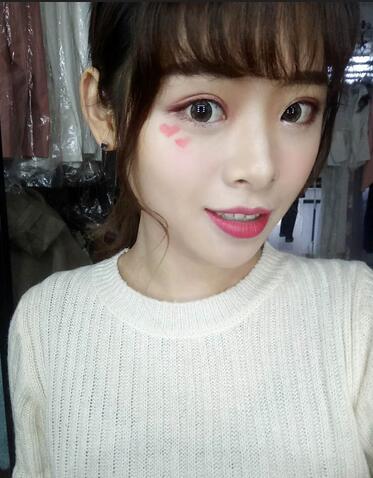 北京熙朵全切雙眼皮1個(gè)月恢復(fù)日記