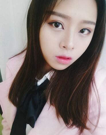 北京熙朵全切雙眼皮1個(gè)月恢復(fù)日記