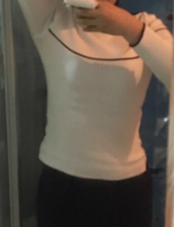 腰腹部吸脂后一個月照片