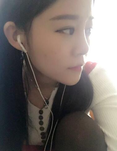 玻尿酸隆鼻恢復過程圖