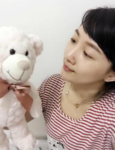 去魚尾紋的很好方法 注射瘦臉去魚尾紋果分享