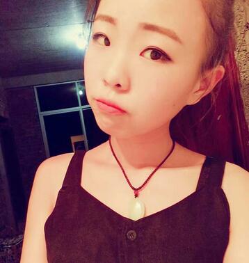 割雙眼皮術(shù)后恢復(fù)過(guò)程 全切雙眼皮3個(gè)月