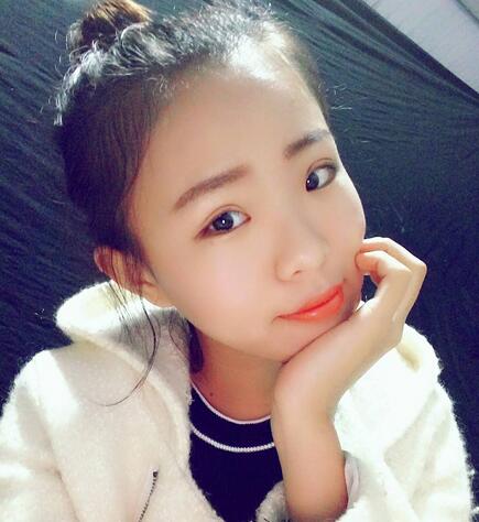 割雙眼皮術(shù)后恢復(fù)過(guò)程 全切雙眼皮3個(gè)月