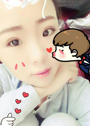 割雙眼皮術(shù)后恢復(fù)過(guò)程 全切雙眼皮3個(gè)月