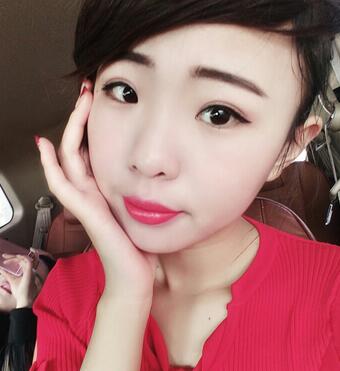 割雙眼皮術(shù)后恢復(fù)過(guò)程 全切雙眼皮3個(gè)月