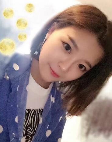 雙眼皮+開眼角3個月恢復過程圖