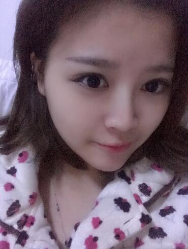 雙眼皮+開眼角3個月恢復過程圖