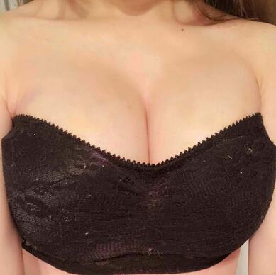 自體脂肪豐胸之后多久能上班 北京麗星豐胸恢復紀實